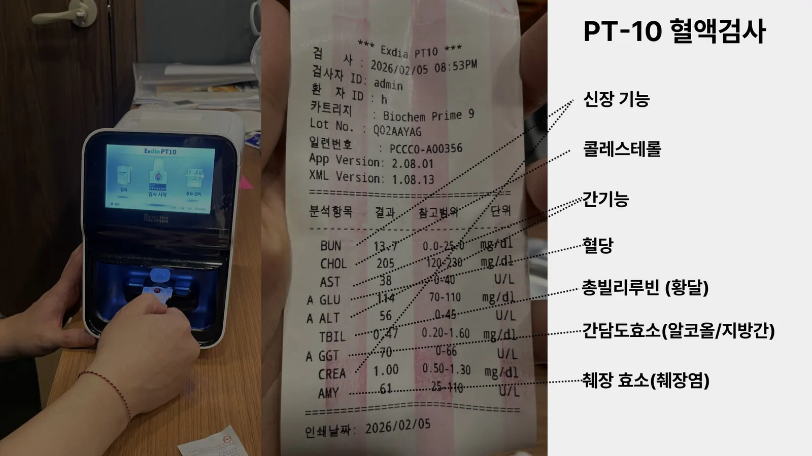 혈액검사