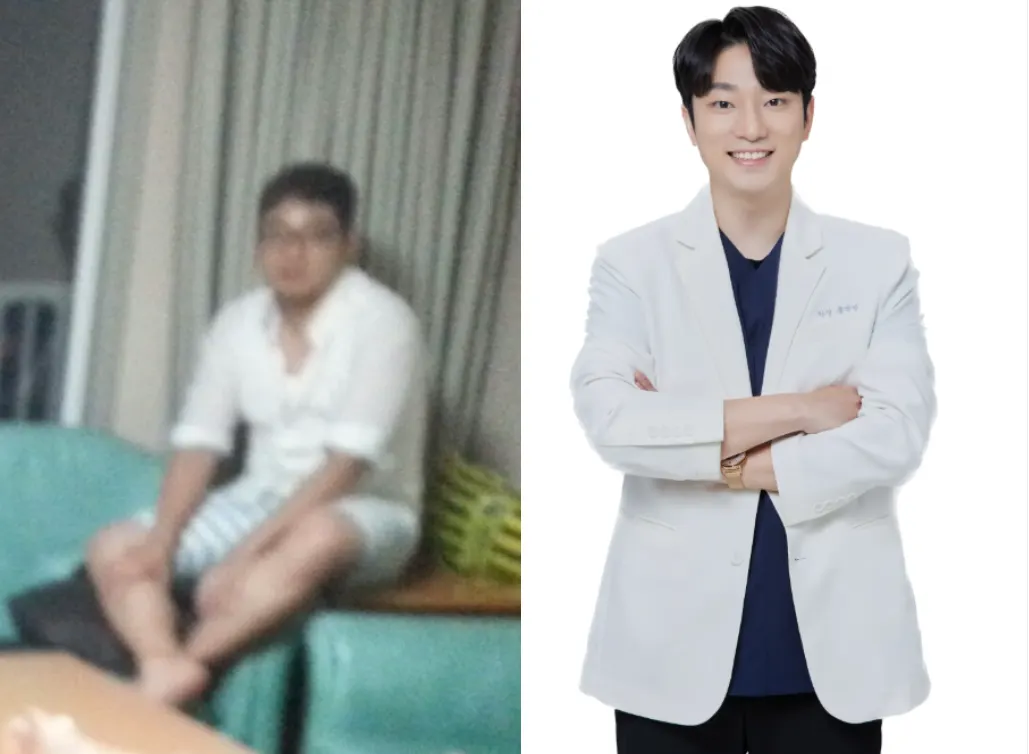 다이어트 비포/애프터